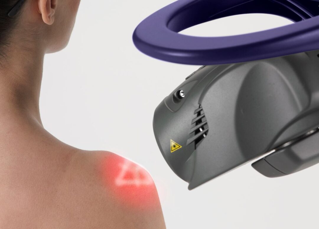 MLS Laser Therapy: revolutionising pain relief & recovery for Coasties